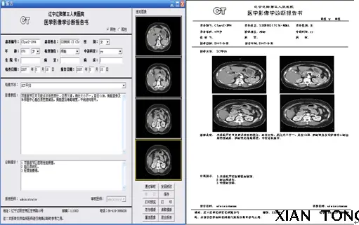 HIS医院系统管理PACS源码