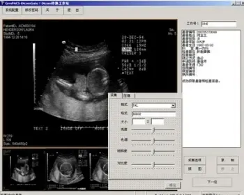 大型医院管理系统源码 PACS超声科室源码 Dicom工作站 C# C/S架构